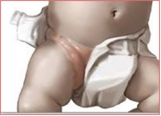 sarpullido torso y espalda